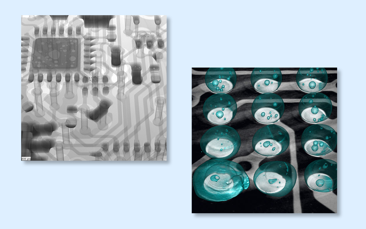 4. 2D vs 3D CT X-ray Which One Do You Really Need? 4. 2D nasuprot 3D CT rendgenu Koji vam stvarno treba?