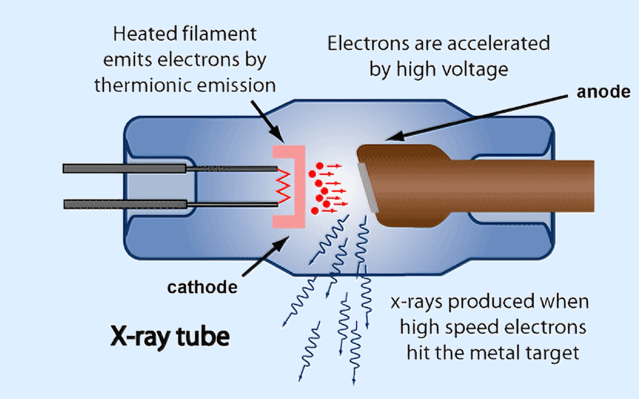 2. What X-ray Technology Actually Does 2. Što rendgenska tehnologija zapravo radi